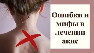 Тема прямого эфира: лечение акне, ошибки в лечении акне, мифы о лечении акне.