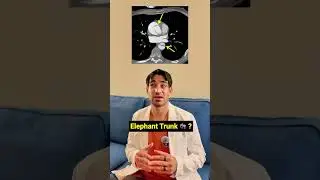 Radiology Rapid Fire 🩻: Can You Get Them All Right? #shorts #doctor #mbbs
