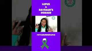 Lupus Treatment is Painful #lupuswarrior