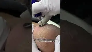 Работа со сложными стопами с ТМ PinkRoyss 