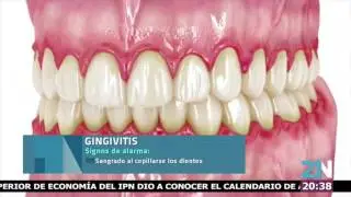 La importancia de la higiene bucal