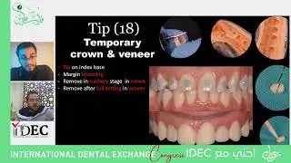 ما تحتاج عن أدوات الPrep والتحضير  في حالات الCrowns 🔥  مع #الدكتور_عبد_العظيم_مصطفى 🇪🇬