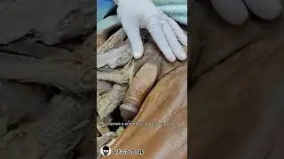 El pene
