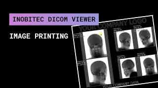 Image printing in Inobitec DICOM Viewer