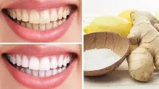 How to whiten teeth at home