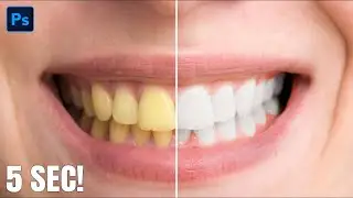 WHITEN TEETH in 5 Sec! - Photoshop Tutorial
