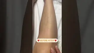 BEFORE AFTER PAKAI WAXING SUGARPOT AMPUH CABUT BULU 