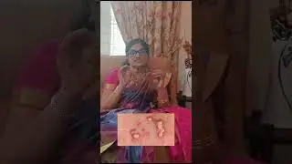 Pap Smear Test: Essential Self - Check for Cervical Cancer After 40 / Malayalam