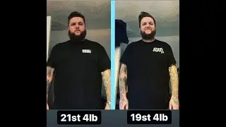My Gastric Sleeve Surgery With Dr Tamer