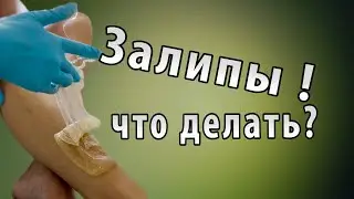 Залипы при шугаринге. Почему залипает  паста при шугаринге?  Как избежать залипов?
