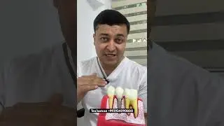 Импланти дандон
