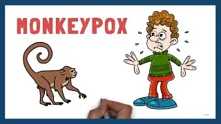 Monkeypox Virus | Introduction 