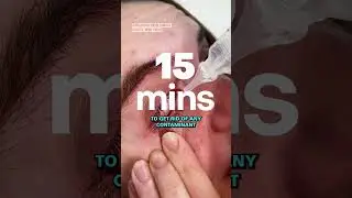 What do you do if you get a scald to the eye? | Health Tips | YouTube Shorts