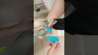 Болезнь Хаглунда-Шинца (больно на пятку наступать)