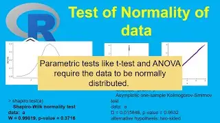 Mastering Normality Tests in R: Graphical & Statistical Methods | Statistics with R