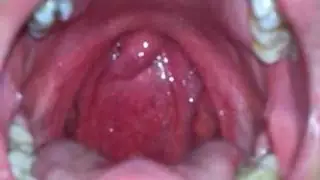 Me swallowing whole orange