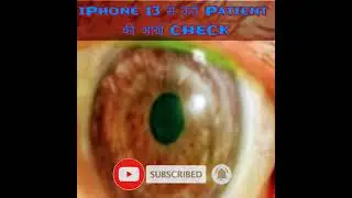 iPhone 13 PRO MAX के Macro Camera से करी Patient की आंखें CHECK #GSF EP6