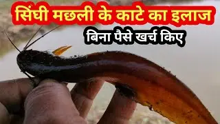 सिंघी मछली के दर्द से तुरंत आराम || बिना खर्च सिंघी मछली के कांटे से हुवे दर्द का इलाज मिनटों में