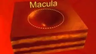 La Degeneración Macular Asociada con la Edad DMAE