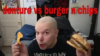 Immediate Denture VS Cheeseburger and Ripple Chips (Week 7)