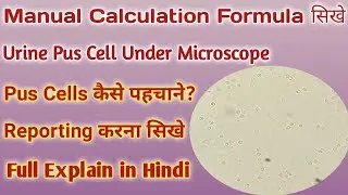 Pus cells under microscope | Pus cells in urine | How to identify urine pus cells