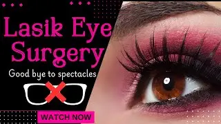 #Lasik Eye Surgery,say Good bye to spectacles,lasik eye surgery live,Best Lasik Eye Surgery cost....