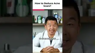 5 Ways To Reduce Acne Scars