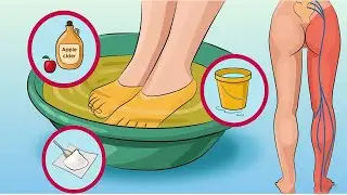 Say Goodbye To Sciatic Nerve Pain With This Simple And Effective Method