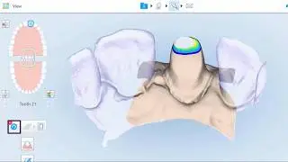 How to use the eraser tool | iTero Element™ intraoral scanners guide