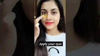Dark Circles Treatment 