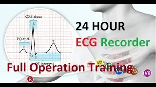24 Hr ECG Holter | Holter user Tutorial in English | Holter machine in Nepal Meditech Holter machine