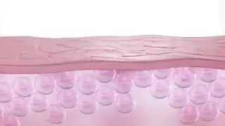 How NOVEXPERT's Hyaluronic Acid Works on the Skin