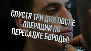 ПЕРЕСАДКА БОРОДЫ. ОТЧЁТ НА 3-Й ДЕНЬ ПОСЛЕ ОПЕРАЦИИ