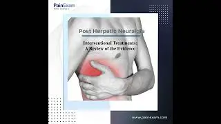 Shingles and  Interventional Pain: A look at the Evidence