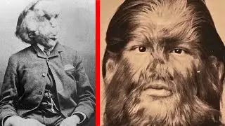 The History of “Freak” Shows