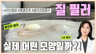질 필러 효과를 못 느꼈던 이유 OOO 때문!