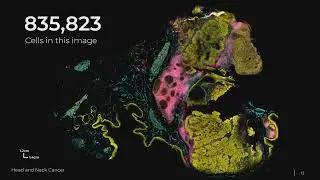 The Power of Spatial Phenotyping: From Discoveries to Actionable Spatial Signatures