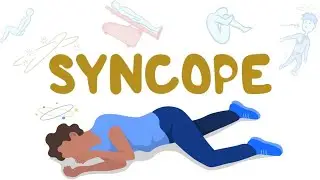 Approach to Syncope