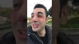 Siz Kimi Dövüyorsunuz Ulan?