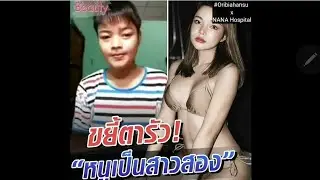 Before After Surgery Male to Female