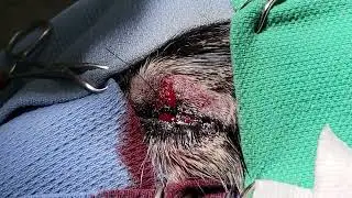 Eyelid mass removal