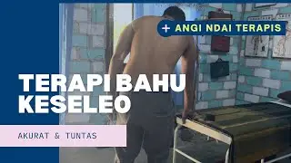Keseleo bahu l l Cedera bahu
