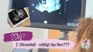 SSW 7 - 2.Ultraschall | Schlägt das Herz??? 🥹 | Mädchen oder Junge? (Ramzi Methode)