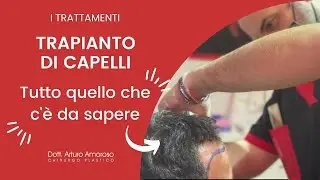 Hair Transplant: Everything You Need to Know - Dr. Arturo Amoroso
