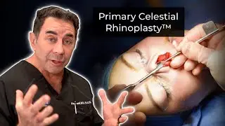 Primary Celestial Rhinoplasty with Dr. Paul Nassif
