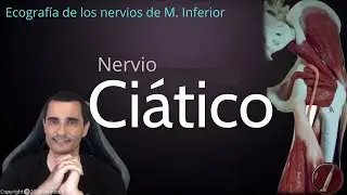 ECOGRAFIA NERVIOS MIEMBRO INFERIOR PARTE I: NERVIO CIÁTICO