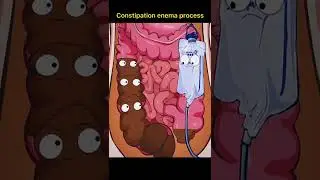 Constipation enema process