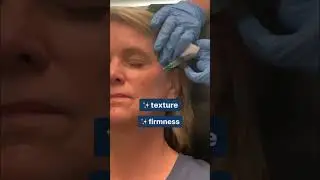 Unlocking Timeless Beauty: The Power of Sculptra