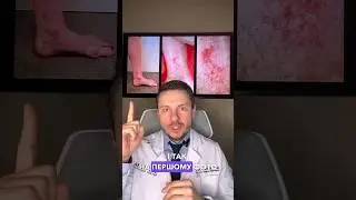 Як флебологи ANGIOLIFE бачать ваші судини🤓