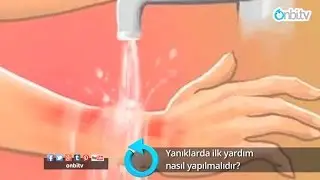 Yanıklarda ilk yardım nasıl yapılır? 